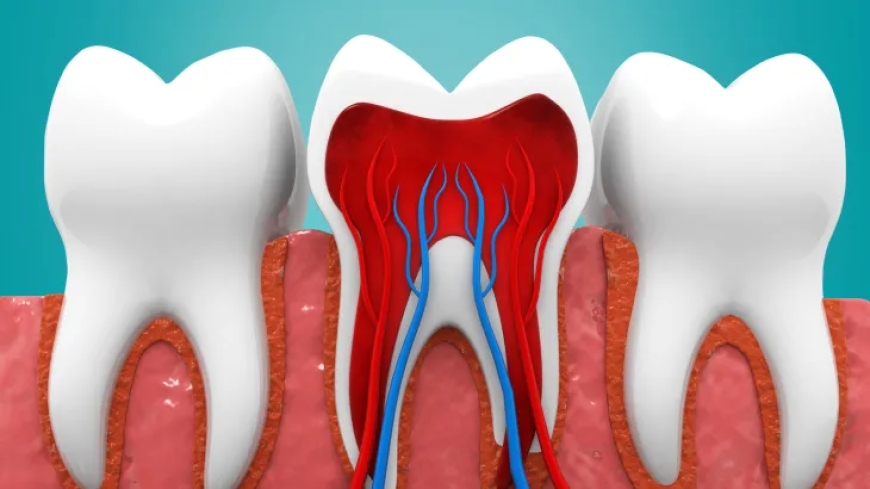 متى تحتاج السن بعد علاج عصبها إلى تركيب؟