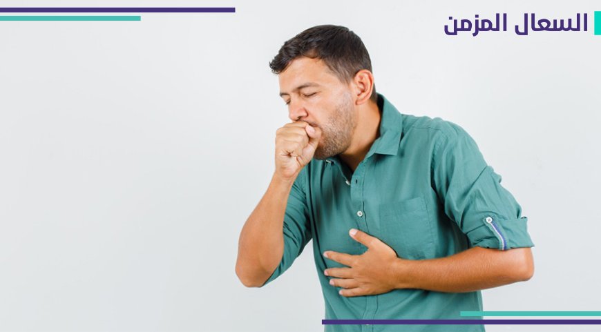 السعال المزمن