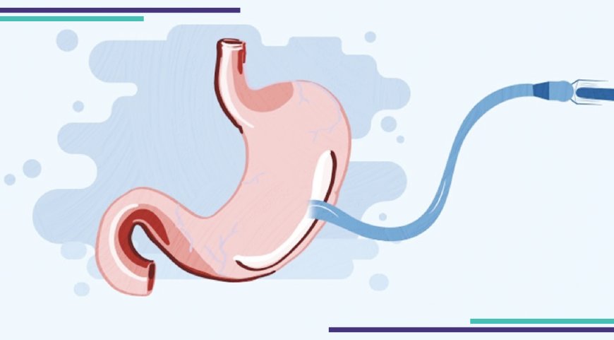 بوتوكس المعدة