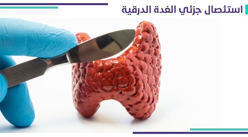 استئصال جزئي للغده الدرقية